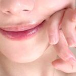 피부 붓기 원인과 관리법 5가지